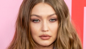 celebrities with noonan syndrome